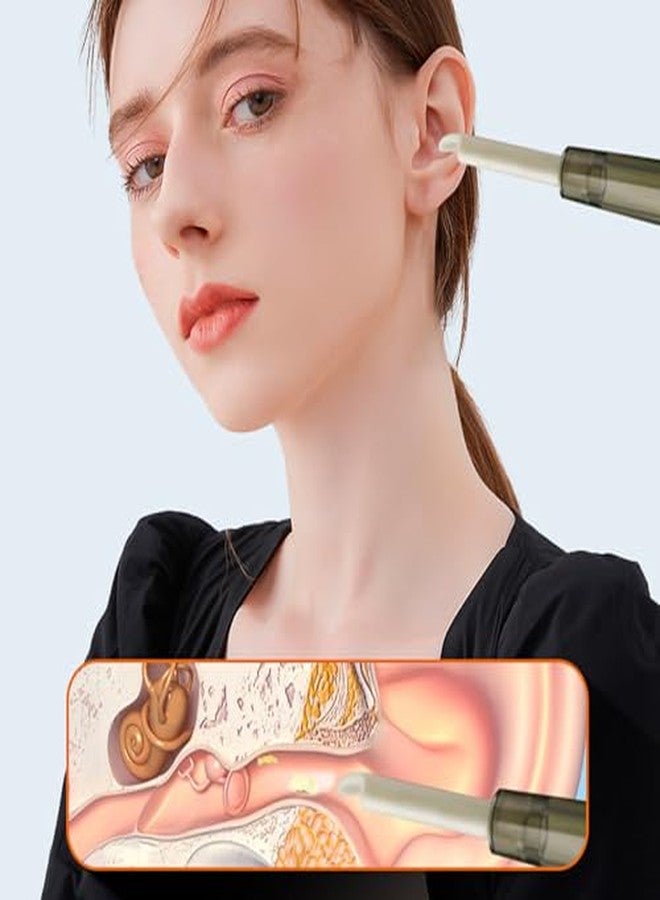 Dpofirs Ear Vacuum Strong Suction, Ear Wax Removal, Ear Vacuum Cleaner, 3 Suction Levels Low Noise Rechargeable Detachable Ear Wax Removal Kit - Image 5